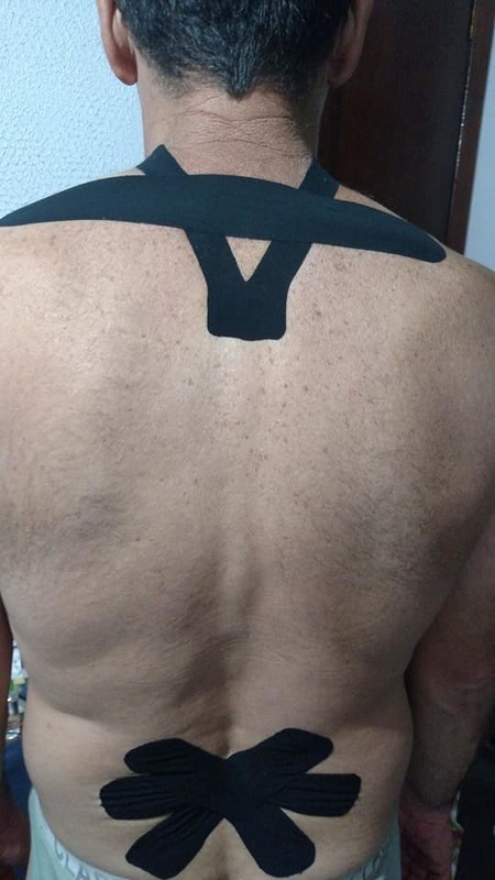 Bandagem elástica no trapézio e lombar outros massoterapeuta aromaterapeuta quiropraxista acupunturista outros