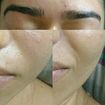 Design de sobrancelha+depilação facial Indiana+clareamento profundo facial de manchas+ limpeza facial+, hidratação profunda acompanhada de drenagem linfática facial simples