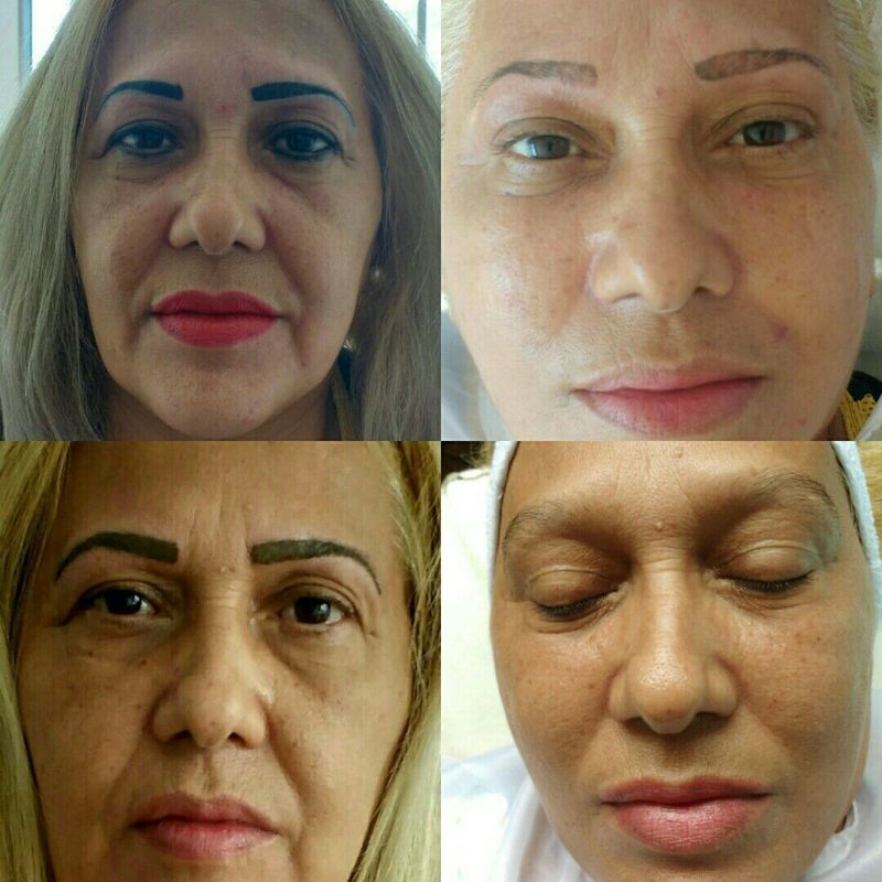 Micropigmentação das sobrancelhas+limpeza facial+ hidratação esteticista designer de sobrancelhas dermopigmentador(a) massoterapeuta micropigmentador(a) podólogo(a) depilador(a)