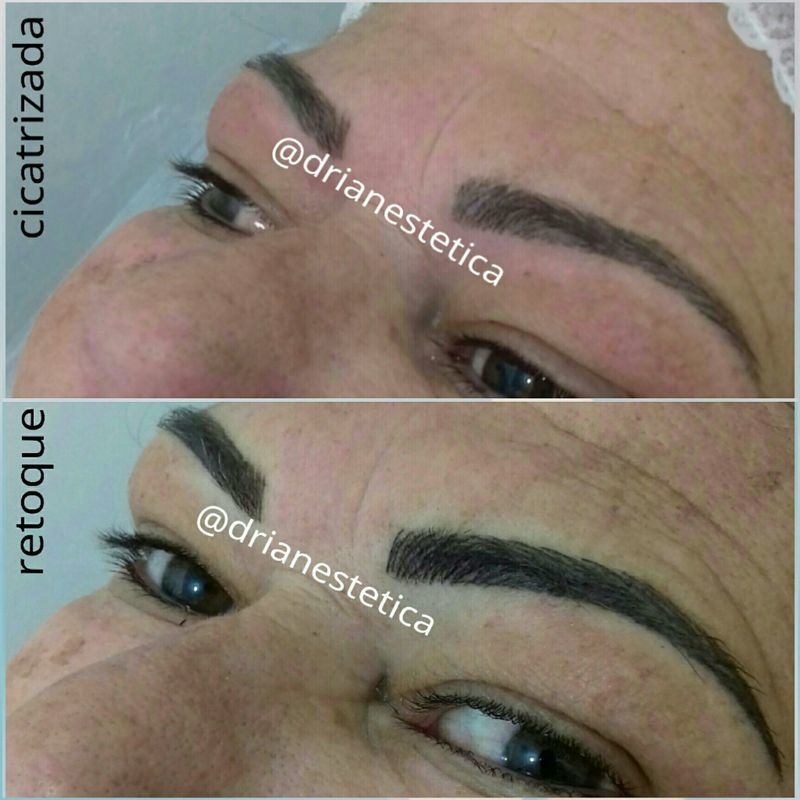 Micropigmentação fio a fio - Retoque após 30 dias. estética micropigmentador(a) designer de sobrancelhas