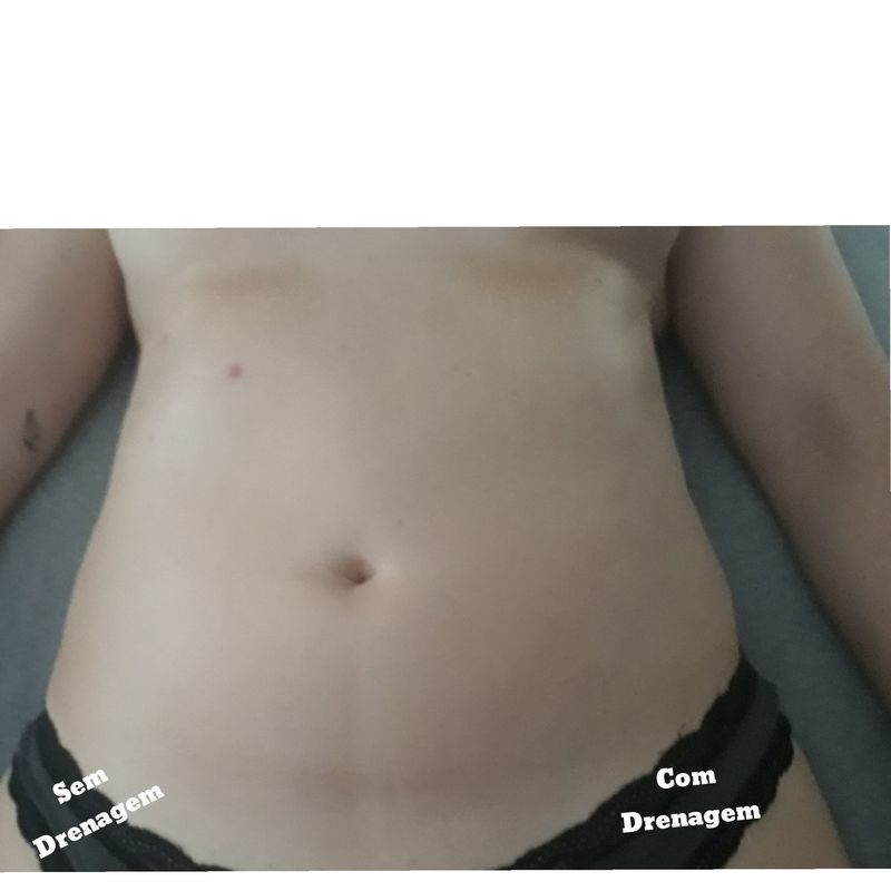 Drenagem linfática Manual estética esteticista