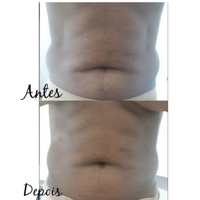 Massagem modeladora estética esteticista