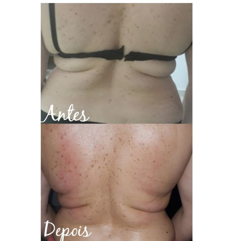 Massagem modeladora estética esteticista