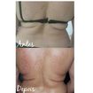 Massagem modeladora