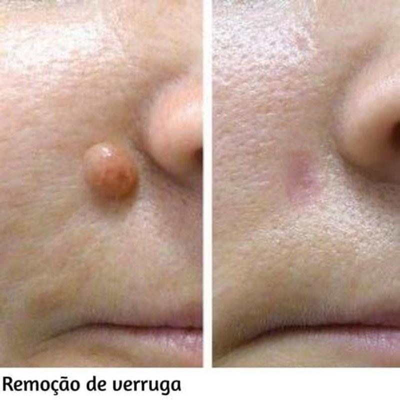 estética depilador(a) esteticista