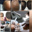 Tricopigmentaçao
Trata alopecia
Melhora a estética
Rejuvenesce
Camufla
Imita o folículo capilar