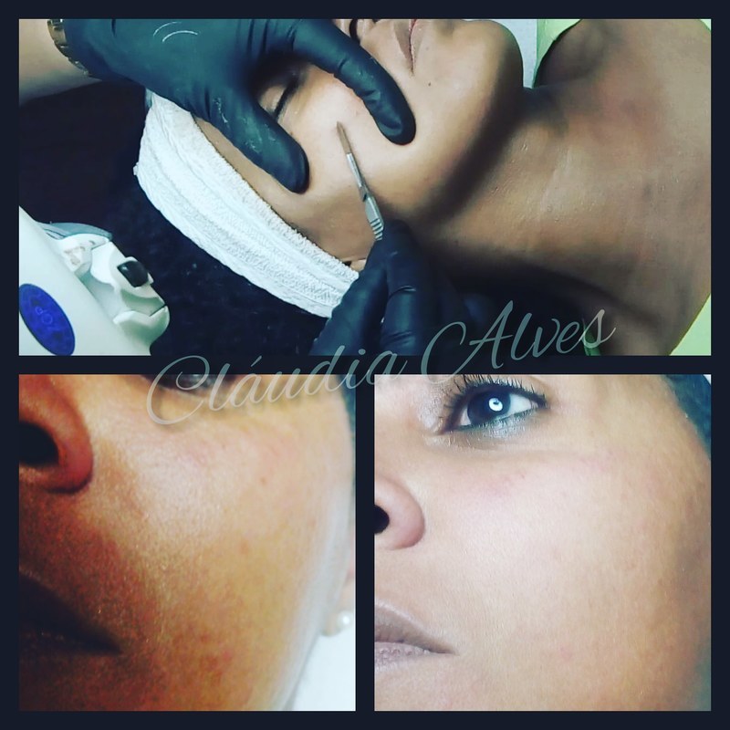 estética micropigmentador(a)