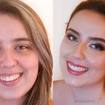 #antesedepois | @makeupadesir 