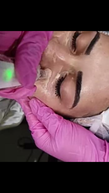 BB glow um efeito de MAKE UP BB CREAM
Técnica coreana de tratamento que promove iluminação na pele 
* Tenha mais liberdade no seu dia a dia
*Tenha um rosto mais saudável
TRATA:*manchas no rosto
*melasma
*Sardas
*Poros dilatados
*Excesso de oleosidade
*Acnes
*Cicatrizes de acnes
*ressecamento d pele
*linhas de expressão
*Olheiras
... estética micropigmentador(a)