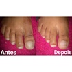 #Aquele#ANTES/DEPOIS