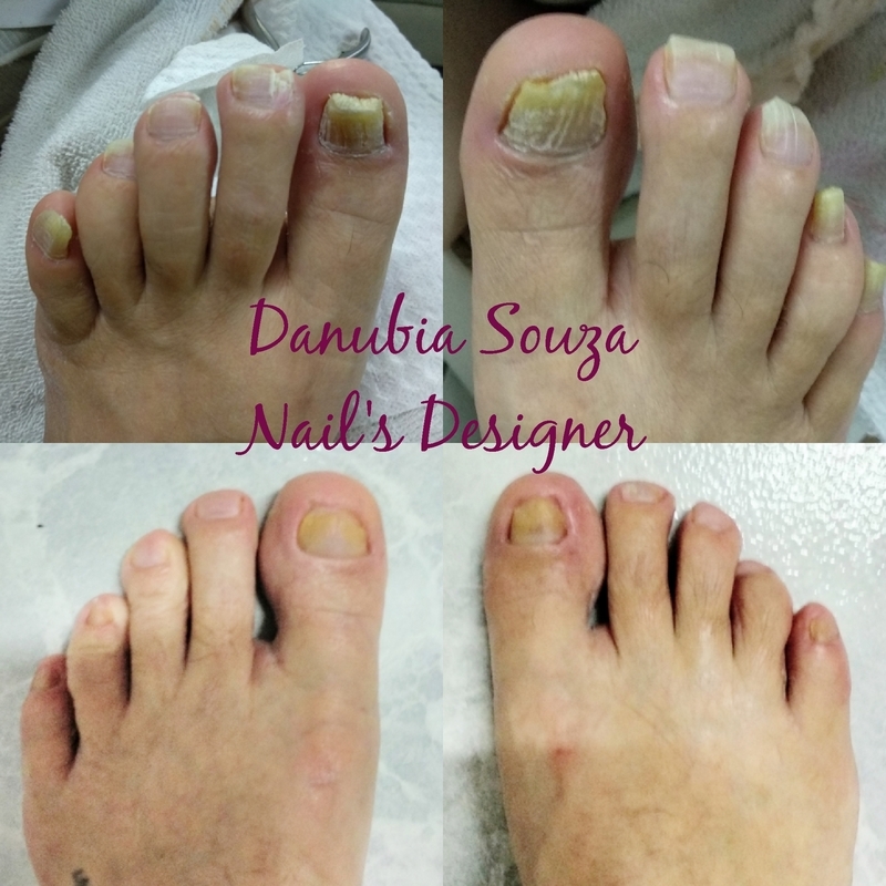 unha manicure e pedicure depilador(a)