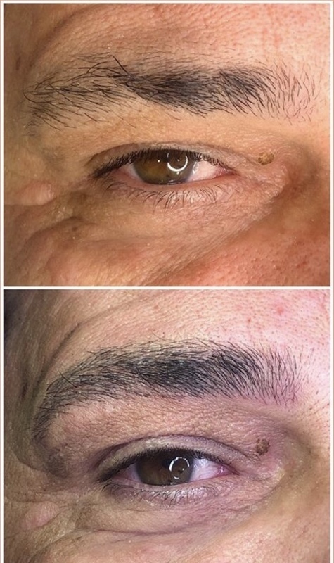 Microblading em Homens
Fio a fio realista  outros designer de sobrancelhas maquiador(a) micropigmentador(a)