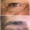 Microblading em Homens
Fio a fio realista 