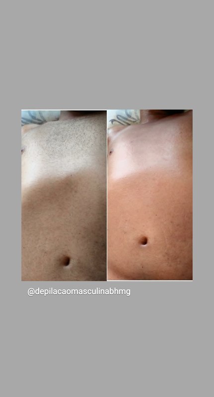 estética depilador(a) esteticista