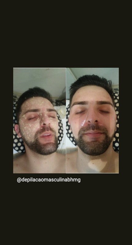 Limpeza de pele estética depilador(a) esteticista