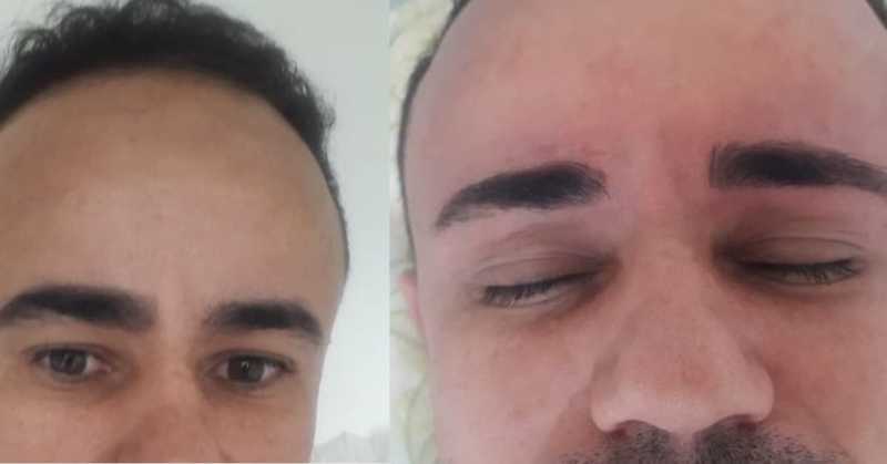 Limpeza sobrancelhas estética depilador(a) esteticista