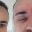 Limpeza sobrancelhas