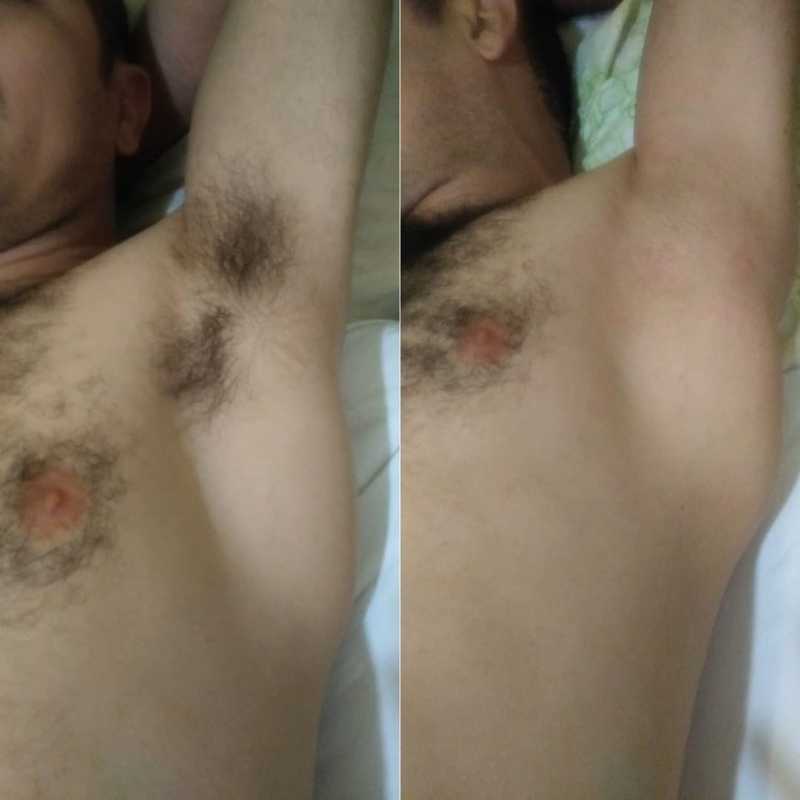 estética depilador(a) esteticista