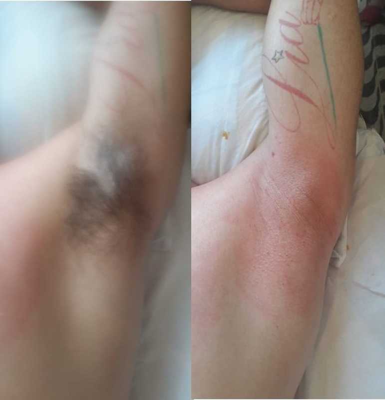 estética depilador(a) esteticista