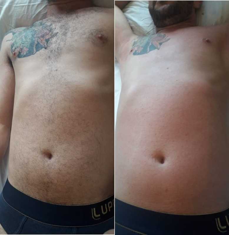 estética depilador(a) esteticista