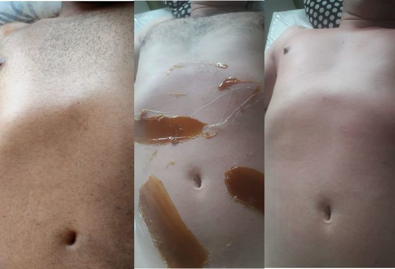 estética depilador(a) esteticista