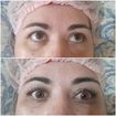 Antes e depois 
Lash lifting