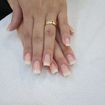 Alogamentos de gel,💅