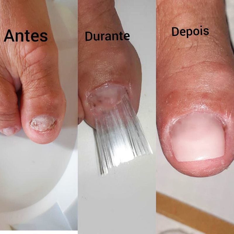 Reconstrução de unha unha manicure e pedicure