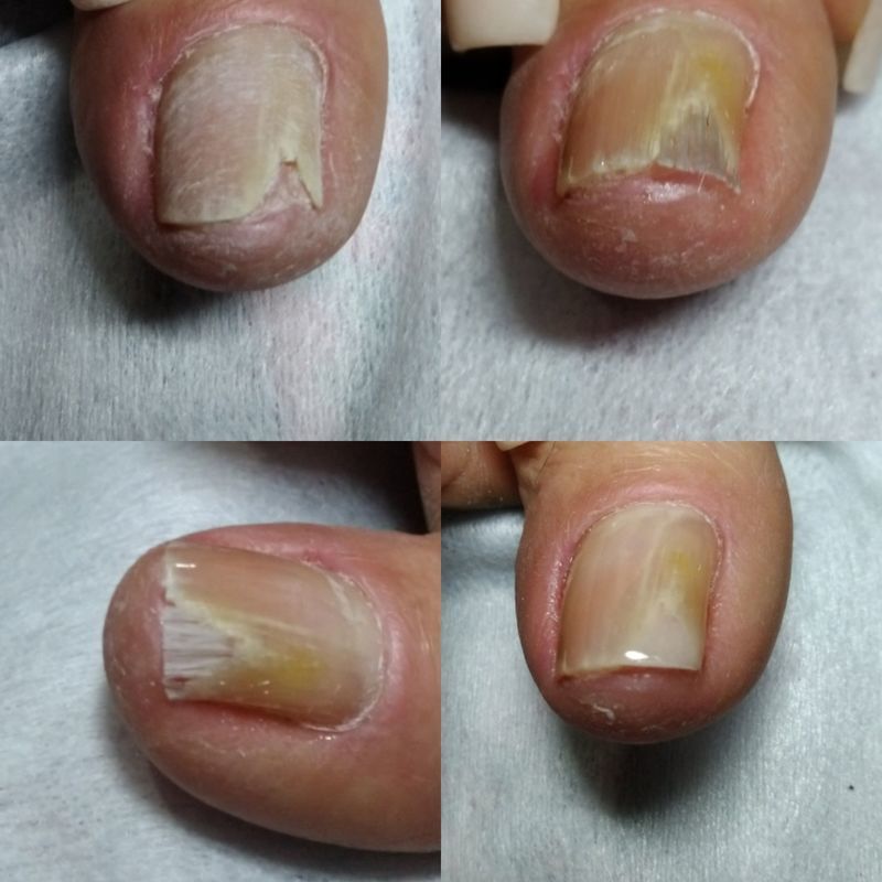 Reconstrução unha manicure e pedicure