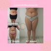 10 sessões de Drenagem Linfática+ Massagem Modeladora.