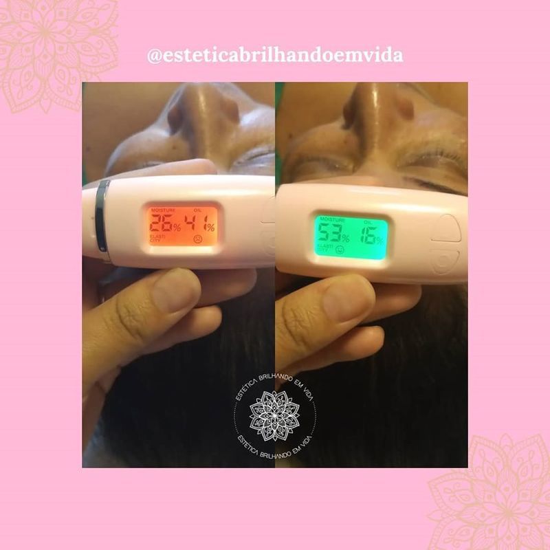 1 sessão de limpeza de pele + hidratação.  estética esteticista assistente esteticista