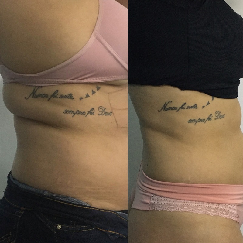 estética esteticista
