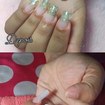 Mais um antes e depois maravigold😏