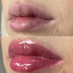 Glow lip, tratamento que restaura e hidrata a mucosa dos lábios.