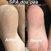 Spa dos pés 
Remoção de calosidade 
Lixamento 
Esfoliação 
Hidratação 