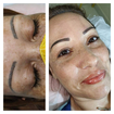 #coverupdesobrancelhas #micropigmentaçãodesobrancelhas
Antes e depois de uma correção, primeiro fizemos uma neutralização e 2 sessões de Micropigmentação com a técnica Esfumada com iluminador abaixo das sobrancelhas. Os lábios também foram micropigmentados técnica de neutralização