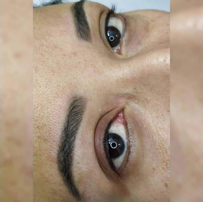 #micropigmentação
Delineador invisível e sobrancelhas micropigmentadas e cicatrizadas estética micropigmentador(a)