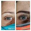 #micropigmentaçãodesobrancelhas
Antes e depois de uma mudança total no olhar com Micropigmentação de Sobrancelhas e Lashlifting nos cílios.