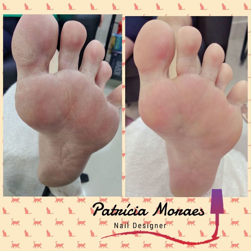Plástica dos pés ❣️
Se você tem pés ásperos ou com rachaduras, agende seu horário, e tenha pés macios 💘 estética manicure e pedicure