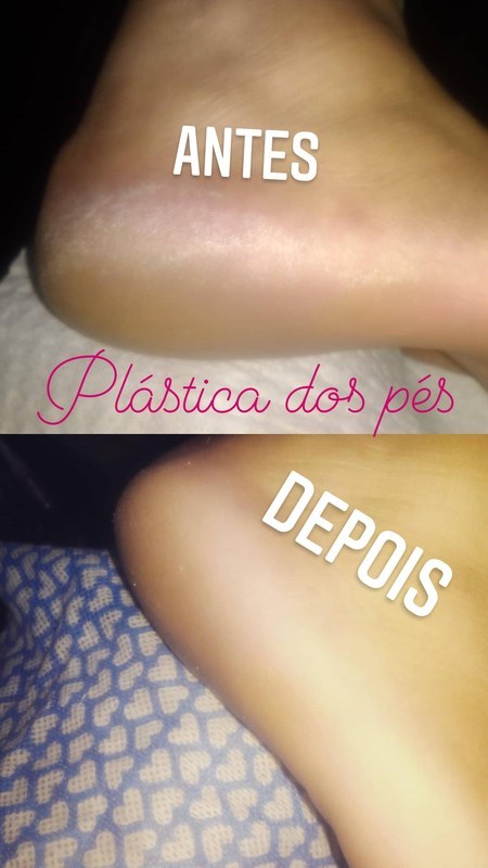 Plastica dos pés  estética designer de sobrancelhas estudante (manicure)