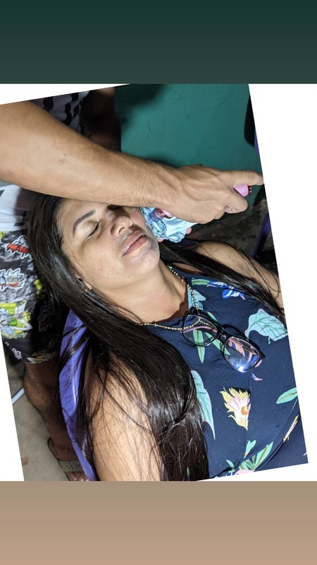 Limpeza de pele completa
Esfoliação, retirada de acnes/cravos, retirada de pelos, sobrancelha grátis, hidratação e drenagem fácial

Fique com ar de pele limpa e renovada, sinta-se jovem e leve novamente 😉 estética massoterapeuta
