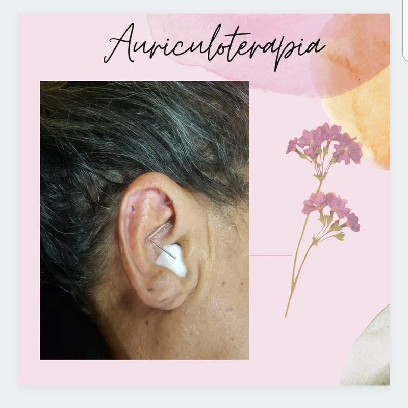 #auriculoterapia #Acupuntura #auricular #terapia integrativa #yin yang # pontos auriculares #auriculoterapia chinesa outros 